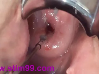 Cervix Fucking Play Yawning chasm Japanese Asian - å­å®®é ¸éƒ¨ã‚¯ã‚½
